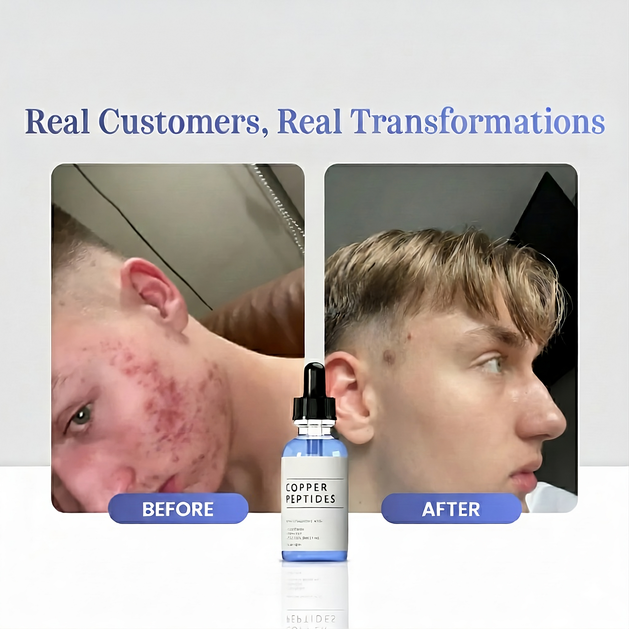 GHK-Cu Peptides Serum Position 5